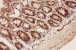 Beclin 1 Antibody in Immunohistochemistry (Paraffin) (IHC (P))