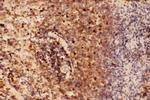 Beclin 1 Antibody in Immunohistochemistry (Paraffin) (IHC (P))