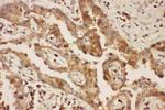 CXCR3 Antibody in Immunohistochemistry (Paraffin) (IHC (P))