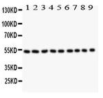 Desmin Antibody in Western Blot (WB)