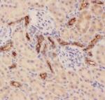 MUC1 Antibody in Immunohistochemistry (Paraffin) (IHC (P))