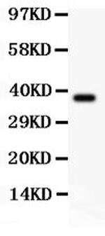 NLRP3 Antibody in Western Blot (WB)