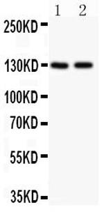 TSC1 Antibody in Western Blot (WB)