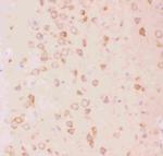TSC2 Antibody in Immunohistochemistry (Paraffin) (IHC (P))