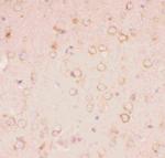 TSC2 Antibody in Immunohistochemistry (Paraffin) (IHC (P))