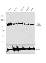 TSC2 Antibody in Western Blot (WB)