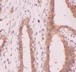 NFkB p52/p100 Antibody in Immunohistochemistry (Paraffin) (IHC (P))