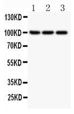 NFkB p52/p100 Antibody in Western Blot (WB)