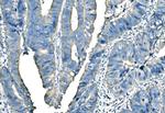 B-Raf Antibody in Immunohistochemistry (Paraffin) (IHC (P))