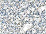 B-Raf Antibody in Immunohistochemistry (Paraffin) (IHC (P))