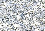 B-Raf Antibody in Immunohistochemistry (Paraffin) (IHC (P))