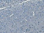 B-Raf Antibody in Immunohistochemistry (Paraffin) (IHC (P))