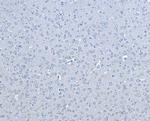 B-Raf Antibody in Immunohistochemistry (Paraffin) (IHC (P))