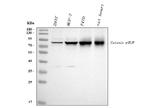 gamma Catenin Antibody in Western Blot (WB)