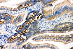 gamma Catenin Antibody in Immunohistochemistry (Paraffin) (IHC (P))