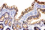 gamma Catenin Antibody in Immunohistochemistry (Frozen) (IHC (F))