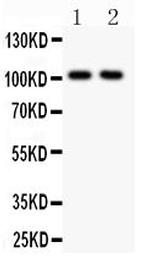 GluR1 Antibody in Western Blot (WB)