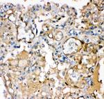 KCNMA1 Antibody in Immunohistochemistry (Paraffin) (IHC (P))