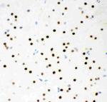 MSK1 Antibody in Immunohistochemistry (Paraffin) (IHC (P))