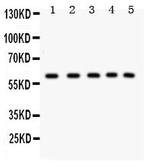 LKB1 Antibody in Western Blot (WB)