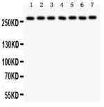 LRRK2 Antibody in Western Blot (WB)