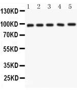 NUP98 Antibody in Western Blot (WB)