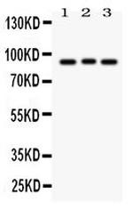 SEMA3A Antibody in Western Blot (WB)