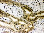 SIRT6 Antibody in Immunohistochemistry (Paraffin) (IHC (P))