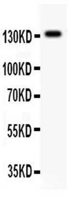 NMDAR2C Antibody in Western Blot (WB)