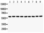 SMAD4 Antibody in Western Blot (WB)