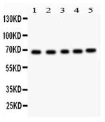 Acetylcholinesterase Antibody in Western Blot (WB)