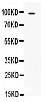 TLR5 Antibody in Western Blot (WB)