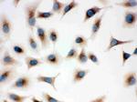 TLR7 Antibody in Immunocytochemistry (ICC/IF)