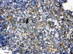 TLR7 Antibody in Immunohistochemistry (Paraffin) (IHC (P))