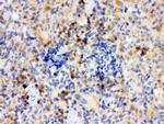 TLR7 Antibody in Immunohistochemistry (Paraffin) (IHC (P))