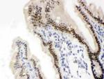 VDR Antibody in Immunohistochemistry (Paraffin) (IHC (P))