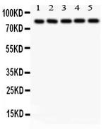 SOX5 Antibody in Western Blot (WB)