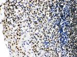 Ku70 Antibody in Immunohistochemistry (Paraffin) (IHC (P))