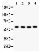 Cdc73 Antibody in Western Blot (WB)