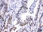 CDK9 Antibody in Immunohistochemistry (Paraffin) (IHC (P))