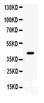 CDK9 Antibody in Western Blot (WB)