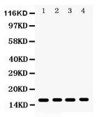 CENPA Antibody in Western Blot (WB)