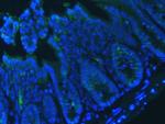 E-cadherin Antibody in Immunohistochemistry (IHC)