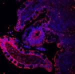 E-cadherin Antibody in Immunohistochemistry (Paraffin) (IHC (P))