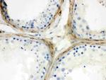 Apolipoprotein J Antibody in Immunohistochemistry (Paraffin) (IHC (P))