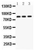 Apolipoprotein J Antibody in Western Blot (WB)