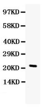 G-CSF Antibody in Western Blot (WB)