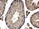 IDH1 Antibody in Immunohistochemistry (Paraffin) (IHC (P))