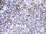 IKAROS Antibody in Immunohistochemistry (Paraffin) (IHC (P))