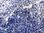 IKAROS Antibody in Immunohistochemistry (Paraffin) (IHC (P))